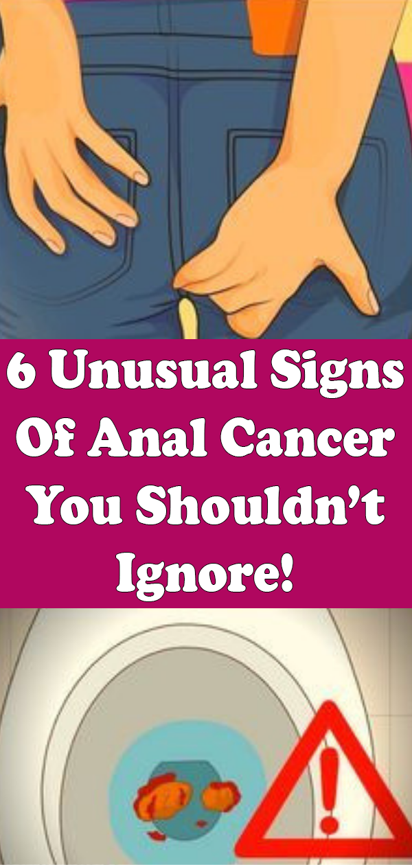 6 Unusual Signs Of Anal Cancer You Shouldnt Ignore Healthy Lifestyle